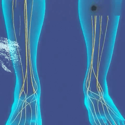 Fast Joint & Varicose Vein Pain Relief Spray 10788165648718-1