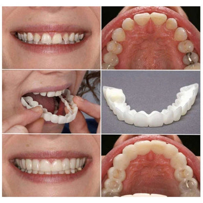 Dental Aligner For Whitening Teeth And Invisible Orthodontic Comfort