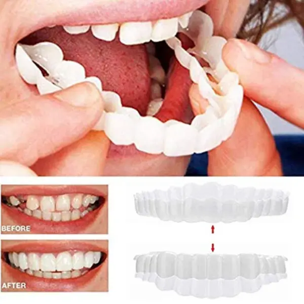 Magic Teeth Snap On Veneers2