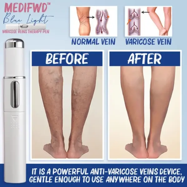 Medifwd Blue Light Therapy Varicose Veins Pen