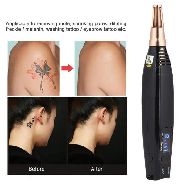 Professional Tattoo Removal Laser Picosecond Pen2