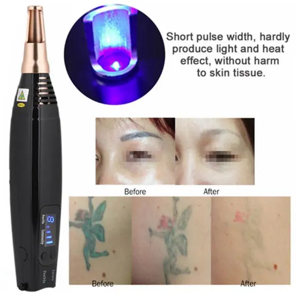 Professional Tattoo Removal Laser Picosecond Pen4