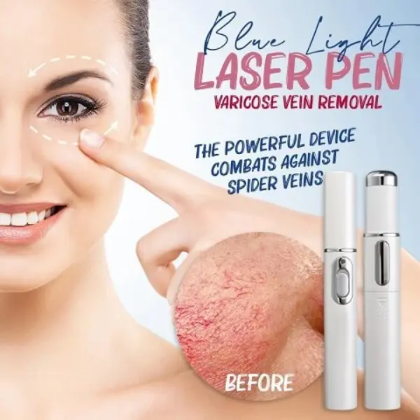 spider-veins-removal-pen