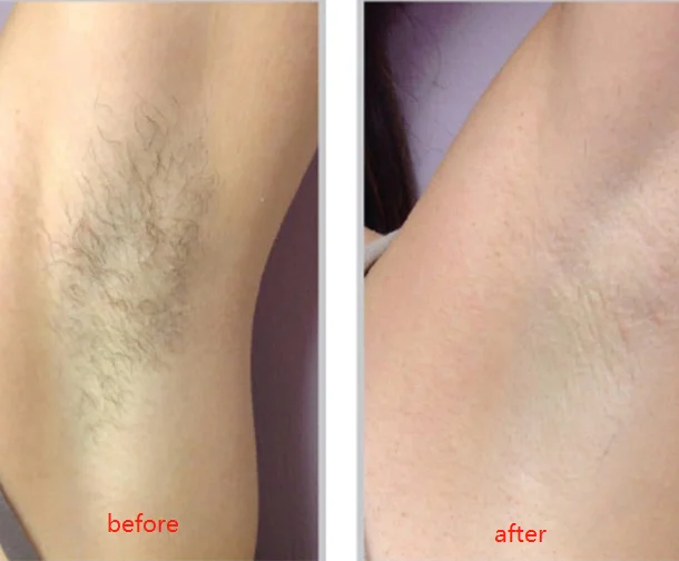 Natural Painless Hair Removal Cream (40g) photo review