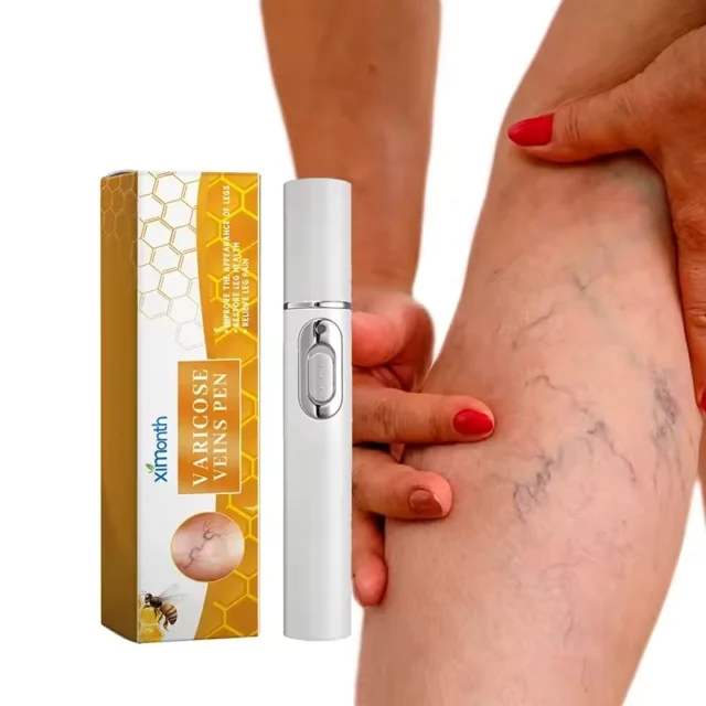 Blue Light Therapy Pen for Spider Vein Treatment